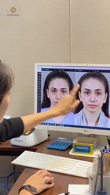 Under-eye consultation at Lienjang Gangnam